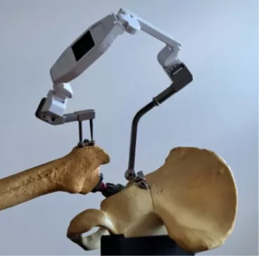 Urządzenie pomiarowe przyłożone do kości stawu biodrowego